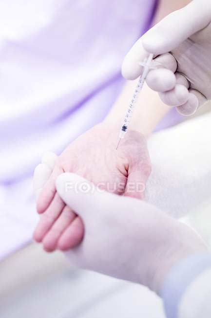 Dermatólogo inyectando botox en la palma para tratar la sudoración excesiva, primer plano . - foto de stock