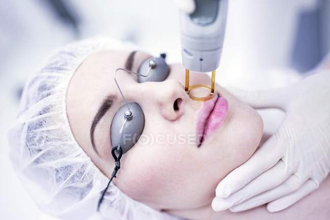 Mujer joven que tiene tratamiento de depilación láser en la cara, primer plano . - foto de stock