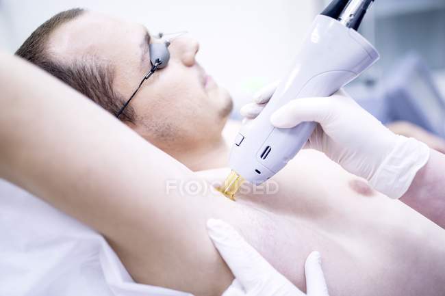 Hombre recibiendo tratamiento de depilación láser para axila . - foto de stock
