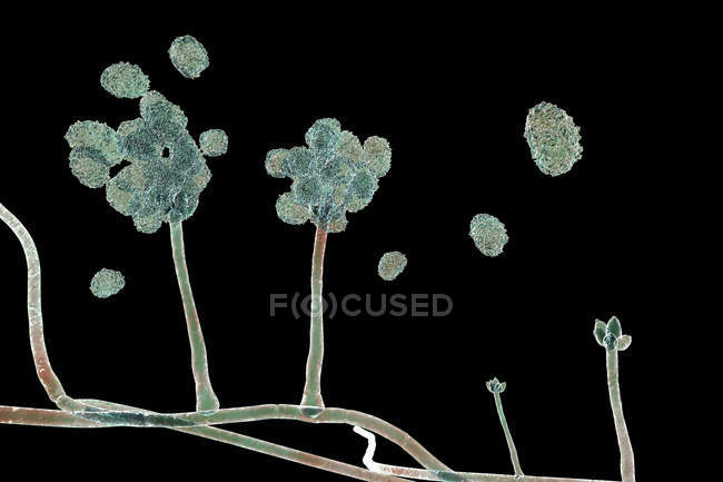 Estructura de fructificación de moldes tóxicos Stachybotrys con esporas, ilustración digital . - foto de stock