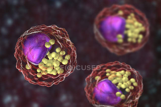 Cellules de mousse macrophagique contenant des gouttelettes lipidiques, illustration numérique
. — Photo de stock