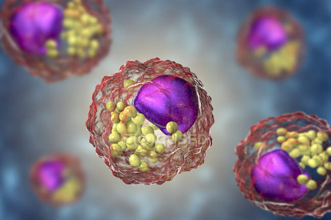 Células de espuma de macrófago que contienen gotitas lipídicas, ilustración digital . - foto de stock