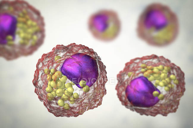 Makrophagen-Schaumzellen, die Fetttröpfchen enthalten, digitale Illustration. — Stockfoto