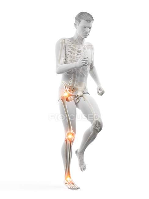 Силуэт мужского бега с болью в суставах, концептуальная иллюстрация . — стоковое фото
