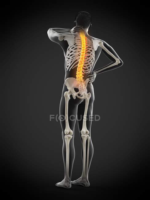 Vue arrière du corps masculin avec maux de dos, illustration conceptuelle . — Photo de stock