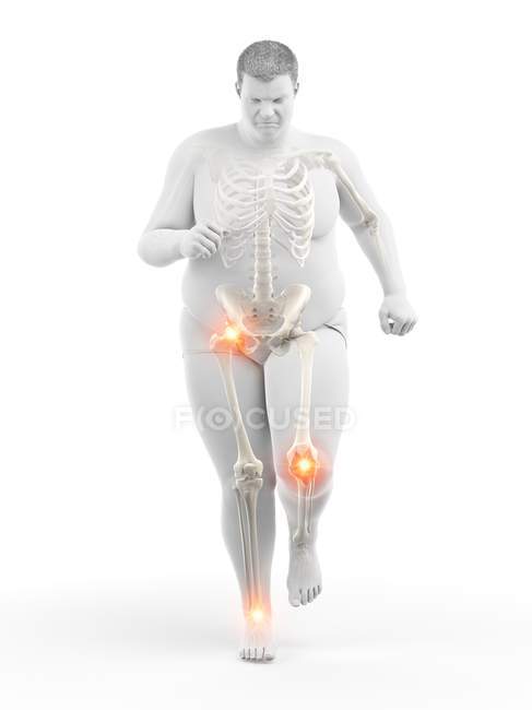 Silhouette de l'homme obèse en cours d'exécution avec douleurs articulaires, illustration informatique . — Photo de stock