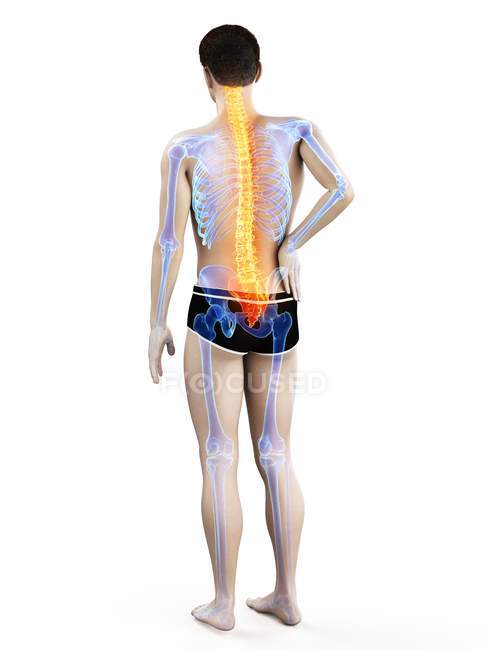 Silueta masculina con dolor de espalda sobre fondo blanco, ilustración conceptual
. — Stock Photo