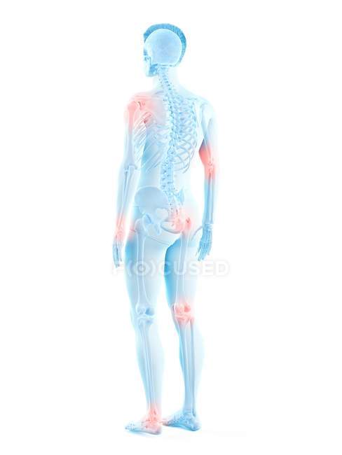 Corpo umano con punti di dolore articolare, illustrazione concettuale . — Foto stock