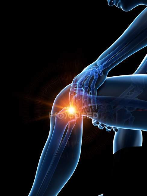 Corpo maschile astratto con dolore visibile al ginocchio, illustrazione digitale . — Foto stock