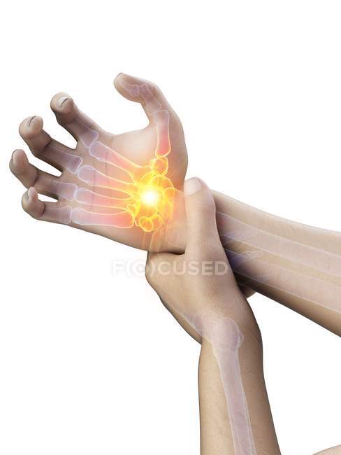 Чоловічі руки з сяючим болем зап'ястка, концептуальний приклад. — стокове фото