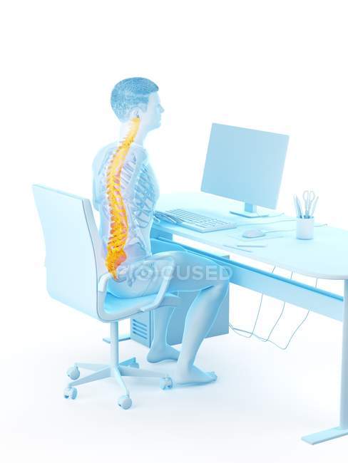 Офісний робочий силует сидить за столом з болем у спині, концептуальна ілюстрація . — стокове фото