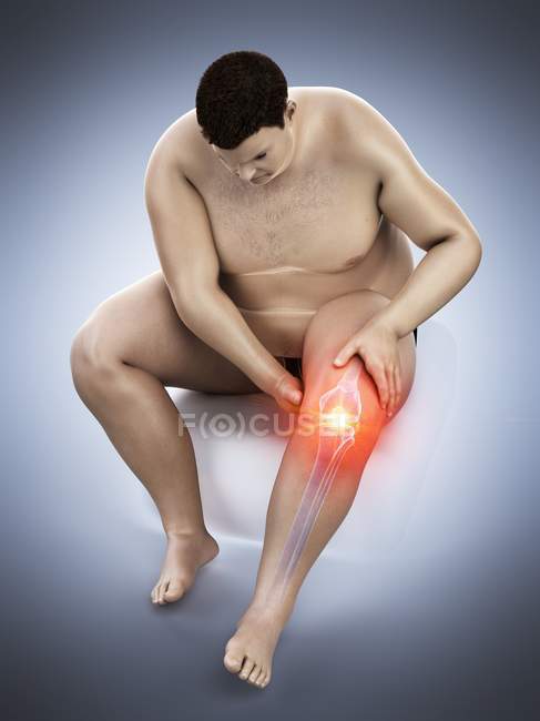 Silhouette d'un homme obèse assis souffrant de douleurs au genou, illustration d'ordinateur . — Photo de stock