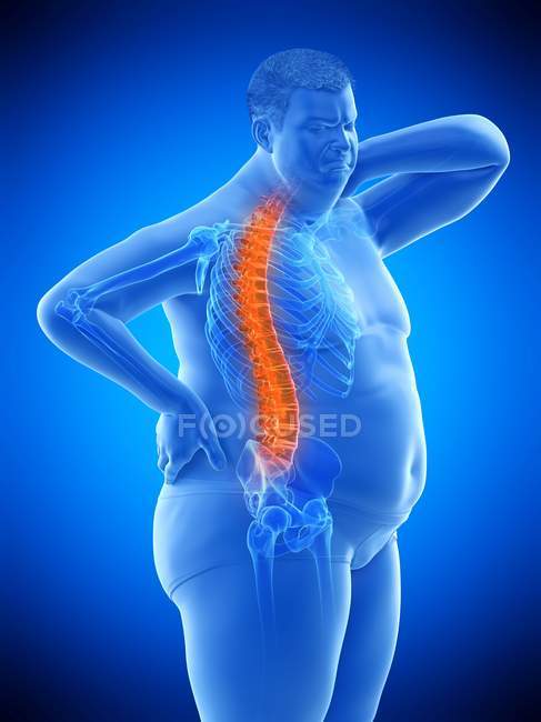 Ожирення чоловічого тіла з болем у спині, цифрова ілюстрація . — стокове фото
