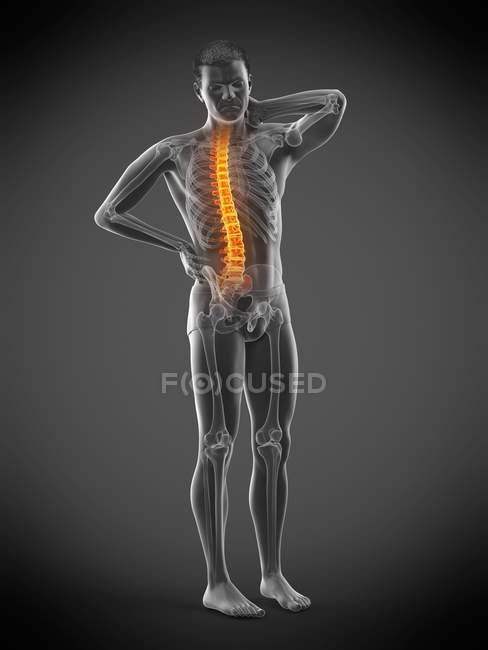 Vista frontale del corpo maschile con mal di schiena, illustrazione concettuale . — Foto stock