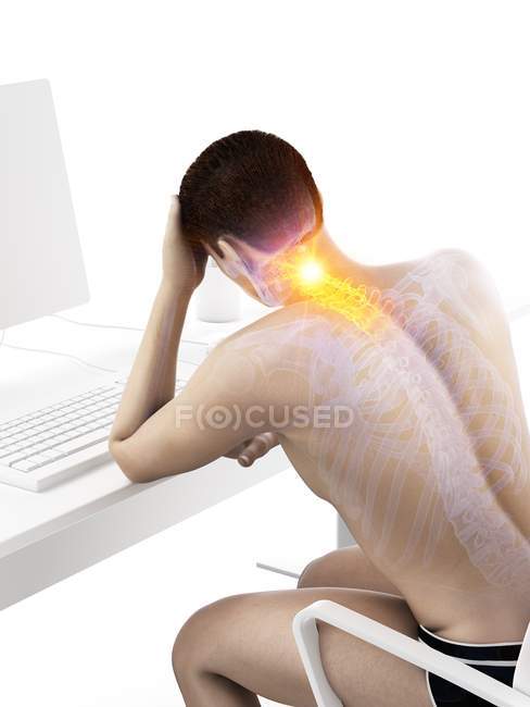 Männliche Büroangestellte am Schreibtisch mit Nackenschmerzen, konzeptionelle digitale Illustration. — Stockfoto