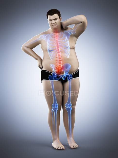 Жирний чоловічий силует повної довжини з болем у спині, цифрова ілюстрація . — стокове фото