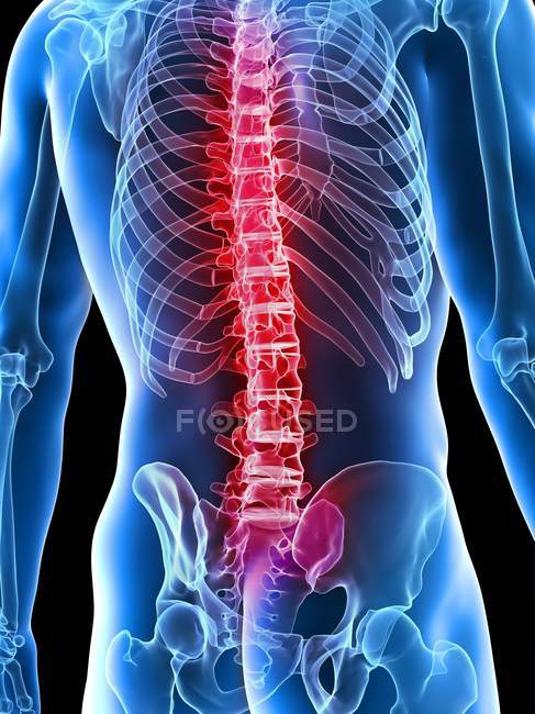 Illustrazione digitale concettuale del mal di schiena nella silhouette umana trasparente . — Foto stock