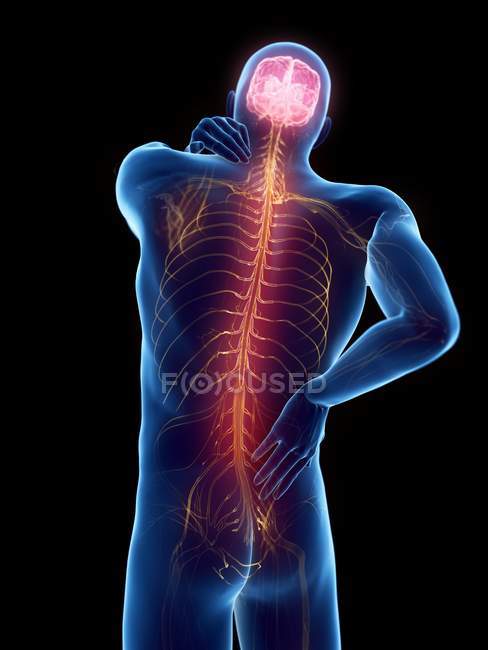 Cuerpo masculino con dolor de espalda sobre fondo negro, ilustración digital
. - foto de stock