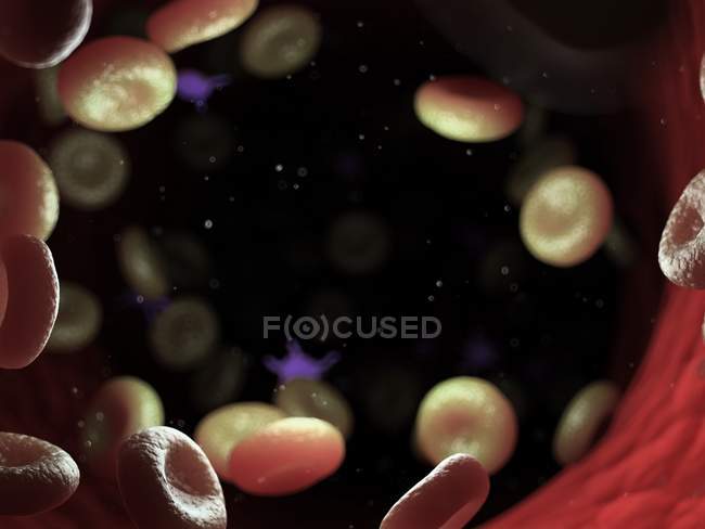 Células sanguíneas enfermas con bacterias, ilustración por computadora
. - foto de stock