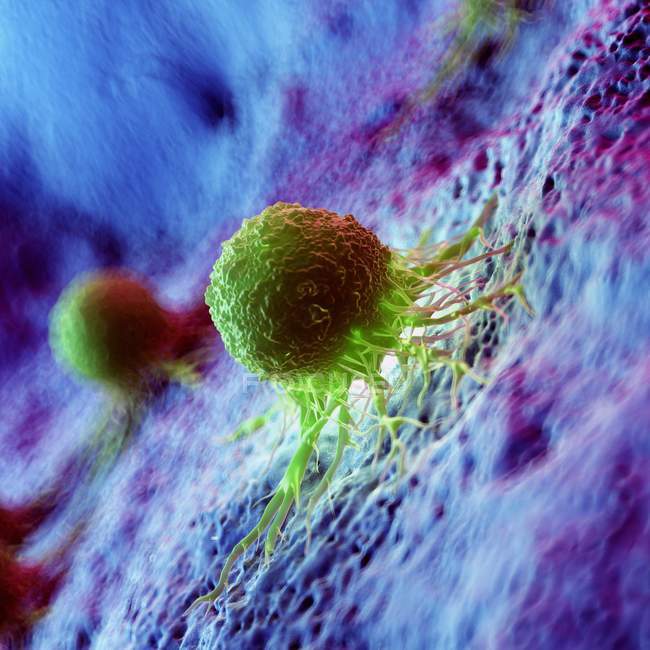 Abstrakte grüne Krebszellen auf Gewebe, digitale Illustration. — Stockfoto