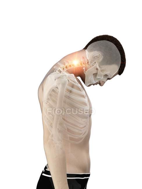 Silhueta masculina abstrata com dor no pescoço, ilustração conceitual . — Fotografia de Stock