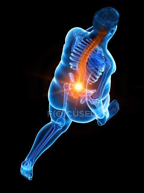 Вид под высоким углом на бегун с избыточным весом с болью в спине, цифровая иллюстрация . — стоковое фото