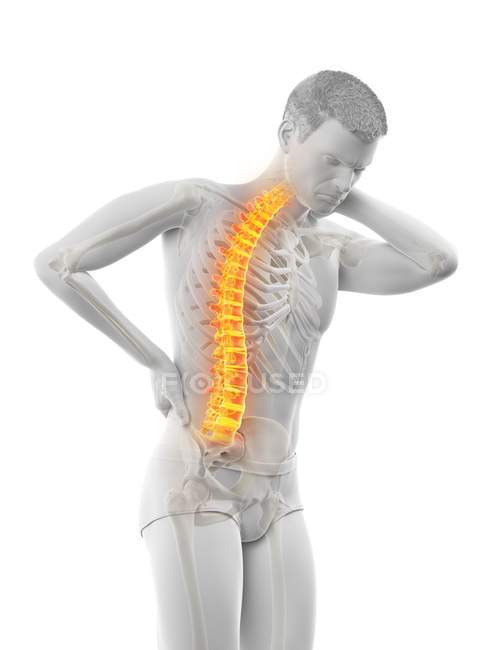 Изгиб мужского тела с болью в спине, концептуальная иллюстрация . — стоковое фото