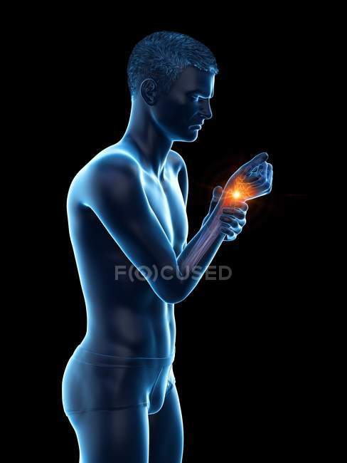 Corpo humano abstrato com dor de pulso, ilustração conceitual . — Fotografia de Stock
