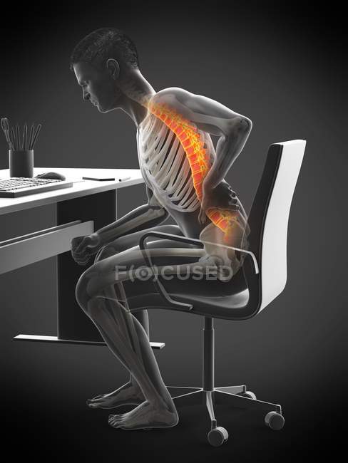 Sentado en el escritorio silueta de trabajador de oficina con dolor de espalda, ilustración conceptual . - foto de stock