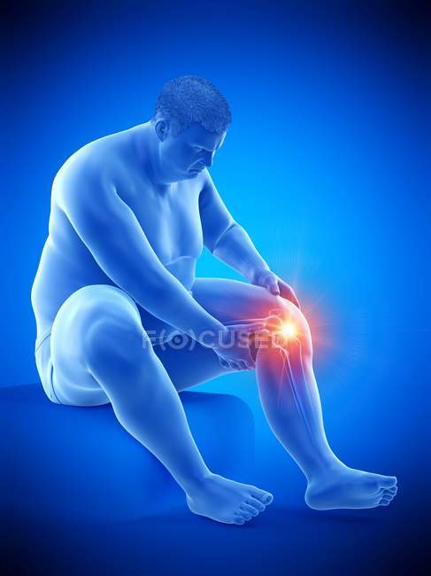 Silhouette of sitting obese man having knee pain, computer illustration. — Stock Photo