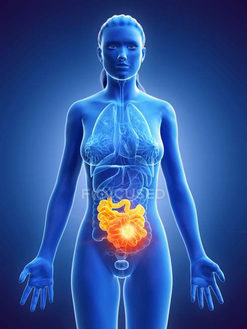 Female silhouette with cancer in small intestine, digital illustration. — Stock Photo