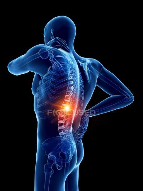Male body with back pain on black background, digital illustration. — Stock Photo