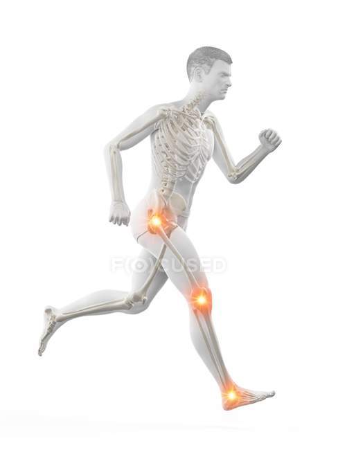 Hombre corriendo con puntos de dolor articular, ilustración conceptual . - foto de stock