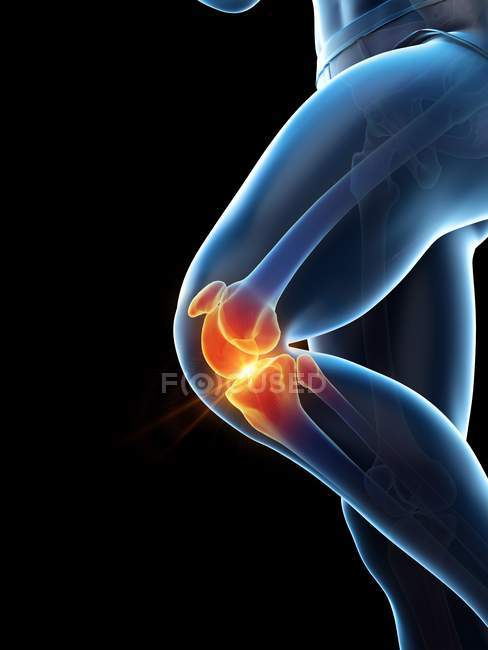 Человеческое тело с болью в колене, концептуальная цифровая иллюстрация
. — стоковое фото