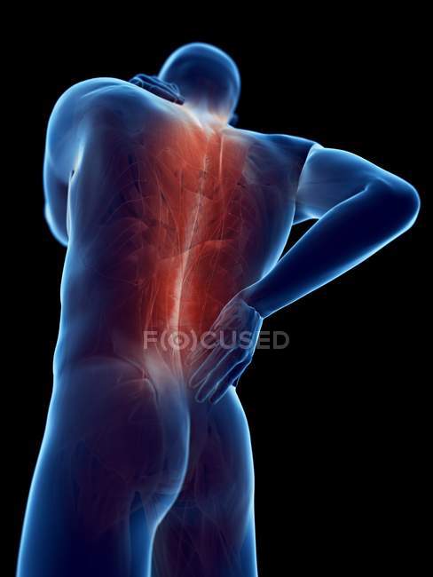 Silhueta do corpo masculino com dor nas costas em visão de baixo ângulo, ilustração digital . — Fotografia de Stock