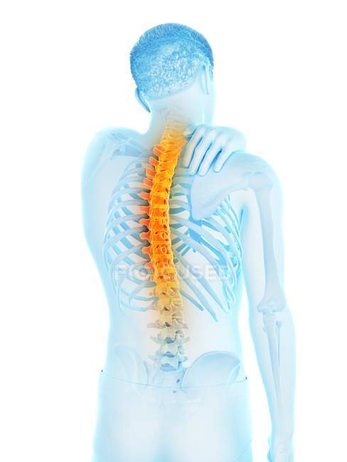 Silueta masculina con la mano en la inflamación del dolor de espalda, ilustración conceptual . - foto de stock
