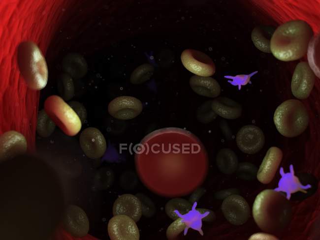 Болезненные клетки крови с бактериями, компьютерная иллюстрация
. — стоковое фото