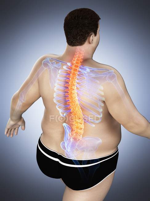 Corps masculin obèse avec maux de dos en vue grand angle, illustration numérique
. — Photo de stock
