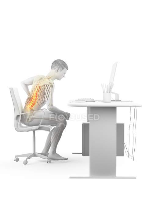 Seitenansicht eines Büroangestellten mit Rückenschmerzen durch das Sitzen am Schreibtisch, konzeptionelle Illustration. — Stockfoto