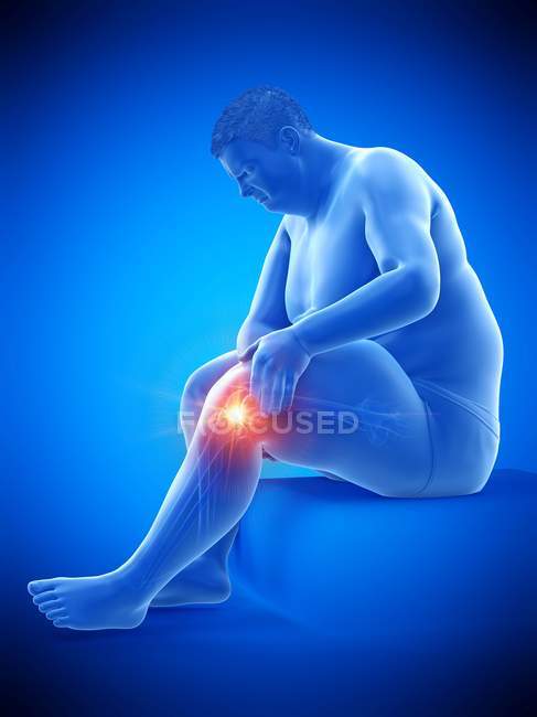 Silhouette eines sitzenden fettleibigen Mannes mit Knieschmerzen, Computerillustration. — Stockfoto