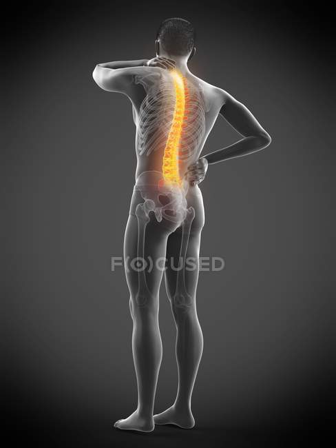 Male body with back pain in rear view, conceptual illustration. — Stock Photo