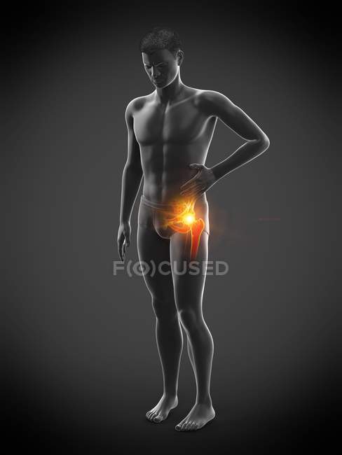 Silueta del hombre con dolor de cadera, ilustración digital . - foto de stock