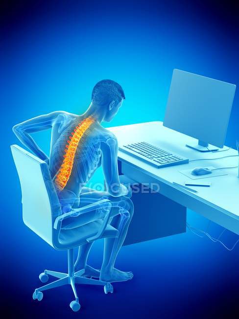 Silhouette d'un employé de bureau souffrant de maux de dos dus à sa position assise, illustration conceptuelle . — Photo de stock