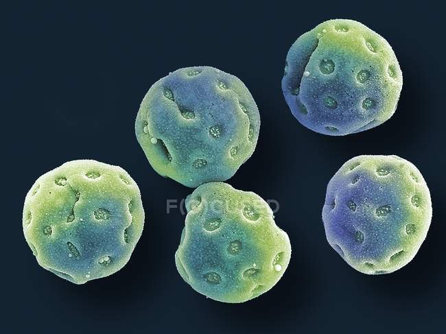 Farbige Rasterelektronenmikroskopie von Pollenkörnern aus der Blütenwolke. — Stockfoto