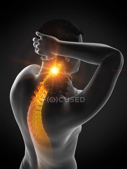 Corps masculin abstrait avec douleur visible au cou, illustration conceptuelle . — Photo de stock