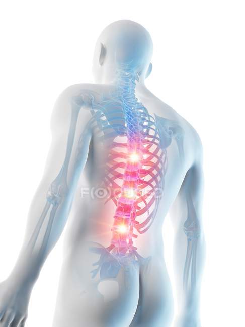 Conceptual digital illustration of back pain in transparent human silhouette. — Stock Photo