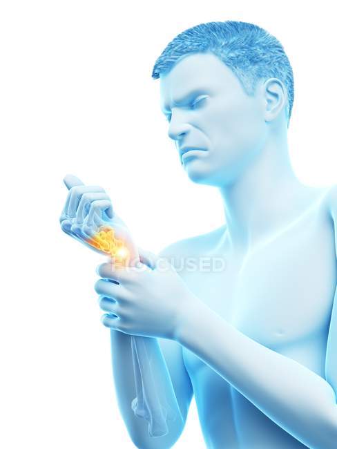 Corpo astratto dell'uomo con dolore al polso, illustrazione concettuale . — Foto stock
