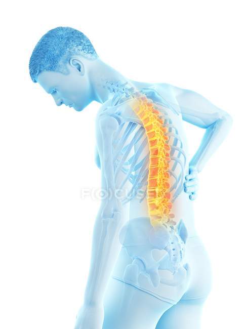 Сгибание мужского силуэта с болью в спине, концептуальная иллюстрация . — стоковое фото