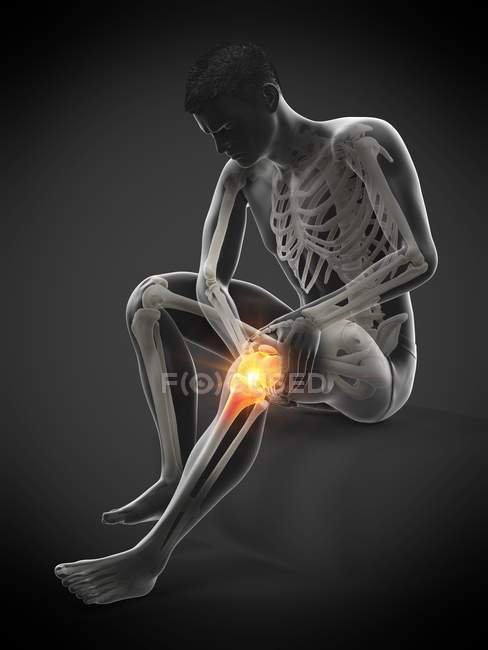 Silhouette d'un homme assis souffrant de douleurs au genou, illustration conceptuelle . — Photo de stock