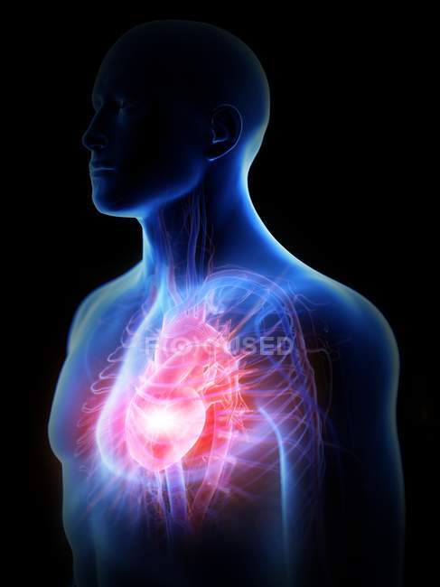 Malattia cardiaca nel corpo maschile, illustrazione concettuale del computer
. — Foto stock